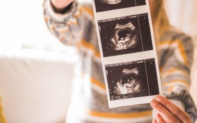 Tipos de ecografías en el embarazo